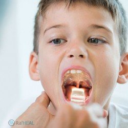 آبسلانگ چراغ دار (آبسلایت) آبسلانگ چراغ دار (آبسلایت)